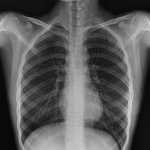 Browiner Beatle-01P Handheld Portable Digital X-Ray System