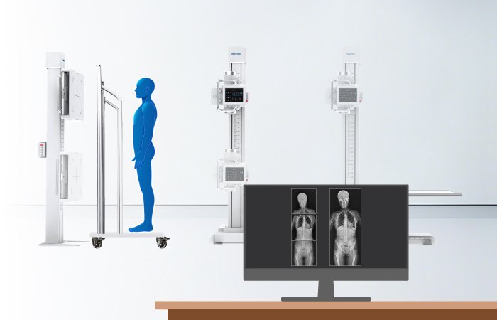 Browiner PerfoX 3000 Plus Floor-Mounted Digital X-Ray System 7 Browiner PerfoX 3000 Plus Floor-Mounted Digital X-Ray System - Image 7