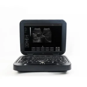 Yonker Black and White Ultrasound Device for Routine Gynecological Examination