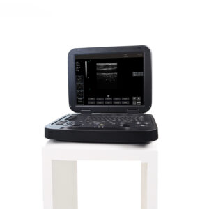 Yonker Black and white Digital Diagnostic Ultrasound System PU-DL151A