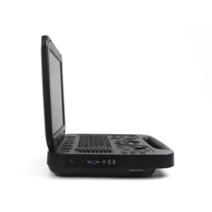 Yonker Black and White Ultrasound Device for Routine Gynecological Examination