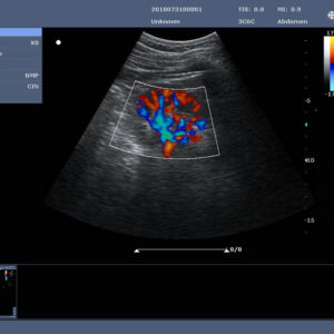 Yonker New Yonker Cheap Portable Color Doppler Ultrasound Machine PU-L151A