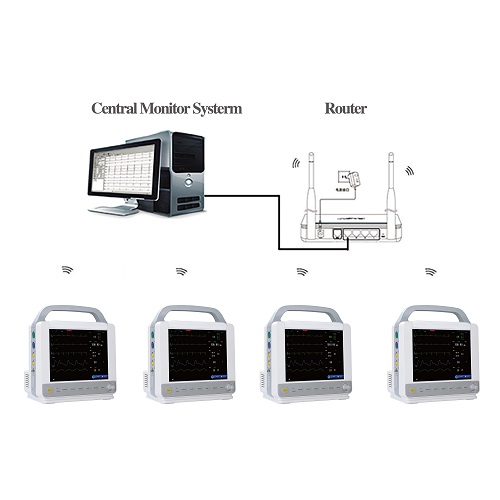 Yonker N8 Neonatal Multipara Patient Monitor in ICU 9 Yonker N8 Neonatal Multipara Patient Monitor in ICU - Image 9