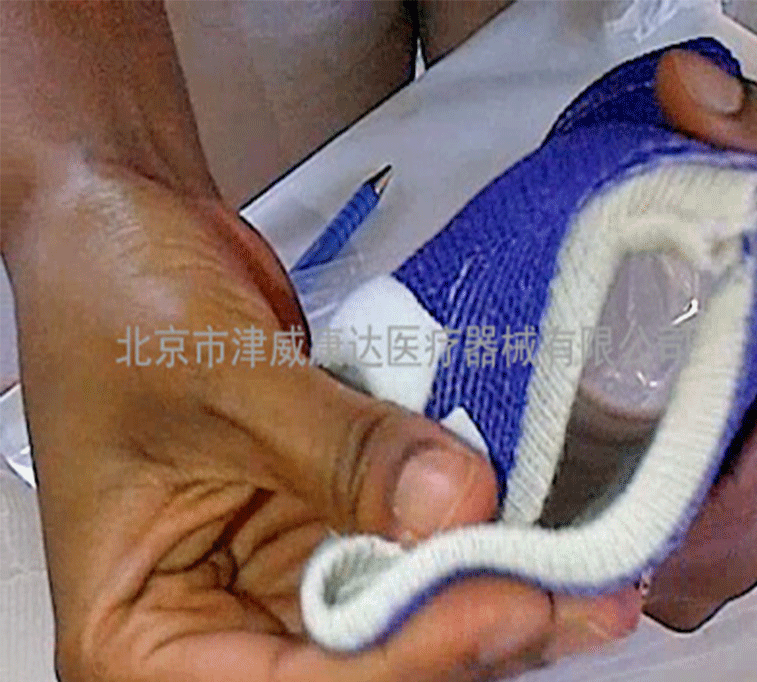 Soft Casting Tape 1 Soft Casting Tape