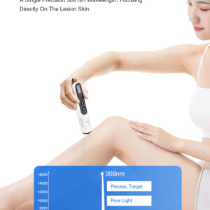 Yonker Handheld UVB Therapy Lamps Treatment