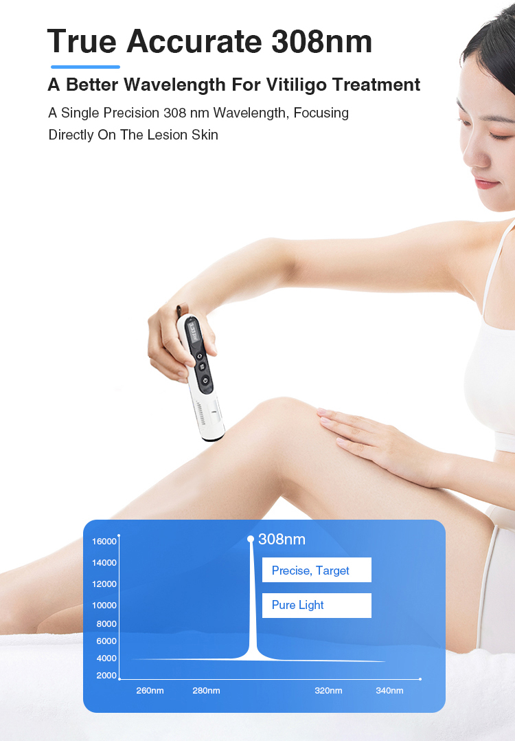 Yonker Handheld UVB Therapy Lamps Treatment 7 Yonker Handheld UVB Therapy Lamps Treatment - Image 7