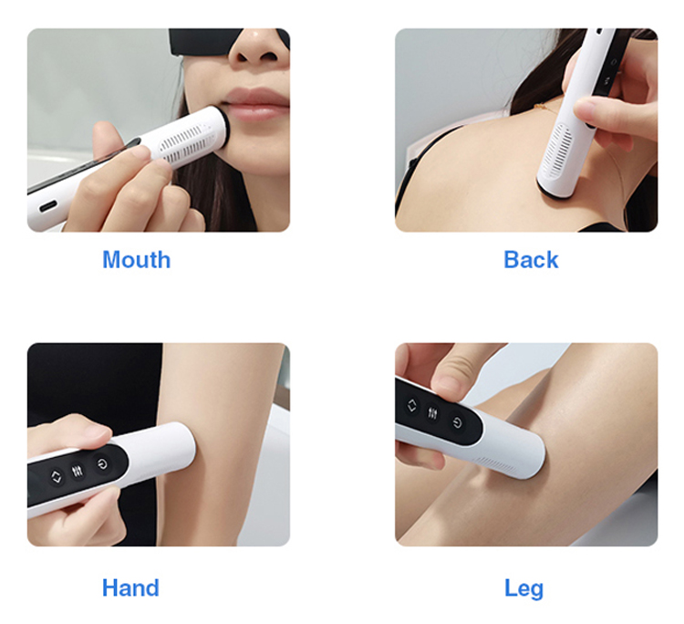 Yonker Handheld UVB Therapy Lamps Treatment 5 Yonker Handheld UVB Therapy Lamps Treatment - Image 5
