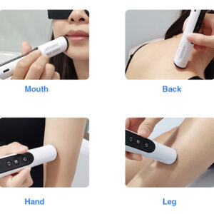 Yonker Handheld UVB Therapy Lamps Treatment