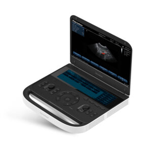 Yonker Premium Diagnostic UItrasound System Revo 9