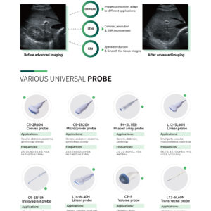 Yonker NEW Premium Diagnostic Ultrasound System Revo T1
