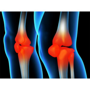 BIOBASE Rheumatism Items