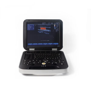 Yonker New Yonker Cheap Portable Color Doppler Ultrasound Machine PU-L151A