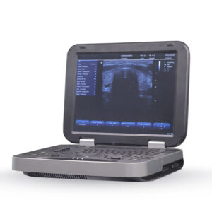 Yonker New Yonker Cheap Portable Color Doppler Ultrasound Machine PU-L151A
