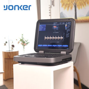 Yonker New Yonker Cheap Portable Color Doppler Ultrasound Machine PU-L151A
