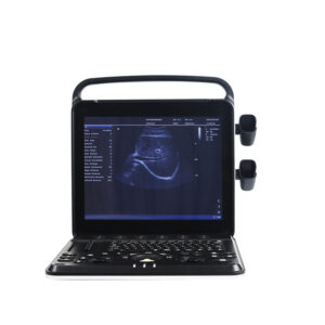 Yonker New Yonker Portable Ultrasound Machine PU-P151A