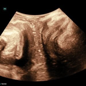 Consona N Series Women’s Health Diagnostic Ultrasound System