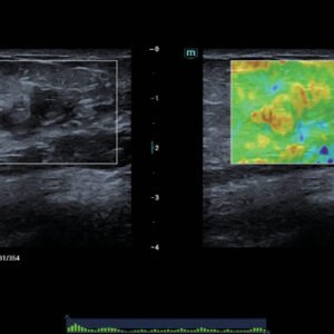 Consona N6 Diagnostic Ultrasound System