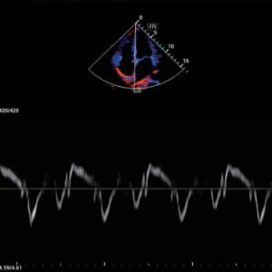 Consona N6 Diagnostic Ultrasound System
