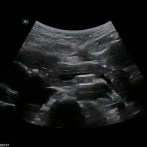 Consona N6 Diagnostic Ultrasound System