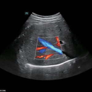 Consona N6 Diagnostic Ultrasound System