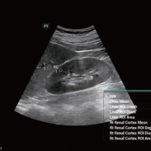 Consona N7 - Diagnostic Ultrasound System