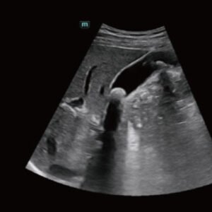 Consona N8 - Diagnostic Ultrasound System