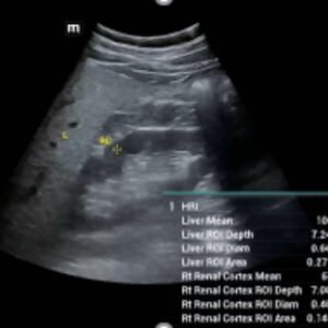 Consona N8 - Diagnostic Ultrasound System