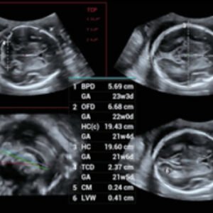 Consona N8 - Diagnostic Ultrasound System