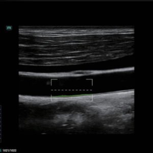 Consona N8 - Diagnostic Ultrasound System