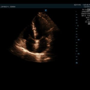 Z.One PRO - Ultrasound System