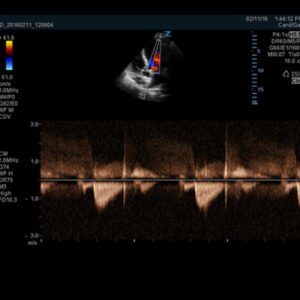 Z.One PRO - Ultrasound System