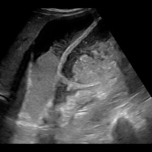 Z.One PRO - Ultrasound System