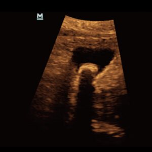 Z50 - Primary Care Ultrasound Systems