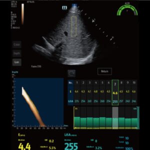 Liver Diseases Diagnostic ultrasound system - Hepatus Series
