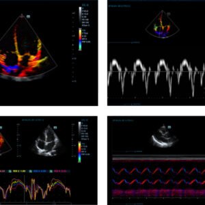 M9 - Ultrasound System