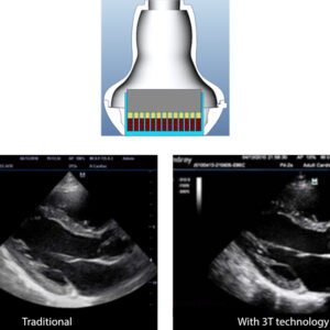 M9 - Ultrasound System