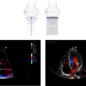 M9 - Ultrasound System