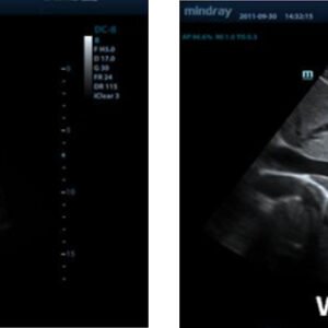 M9 - Ultrasound System