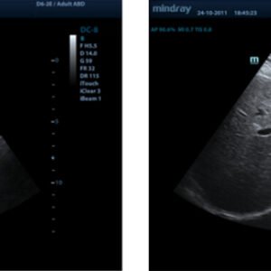 M9 - Ultrasound System