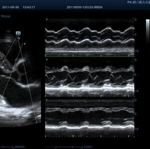M9 - Ultrasound System