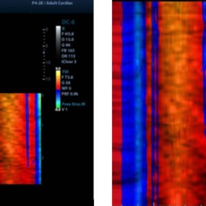 M9 - Ultrasound System