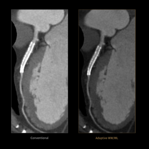 United Imaging uCT Heart