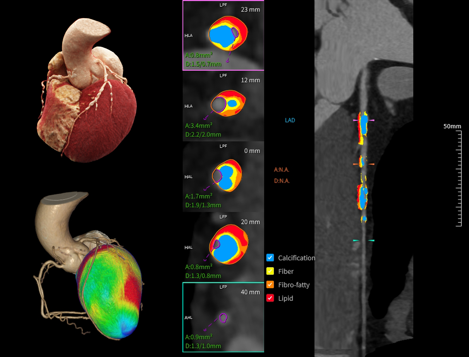 United Imaging uCT Cardiovascular Combined Analysis 1 United Imaging uCT Cardiovascular Combined Analysis