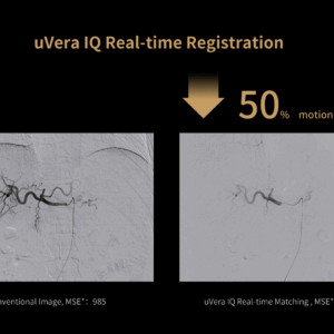 United Imaging uAngio Aviva