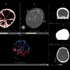 United Imaging uCT Dynamic Analysis