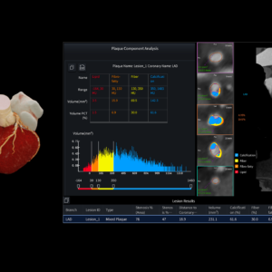 United Imaging uCT Heart