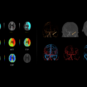United Imaging uCT Dynamic Analysis