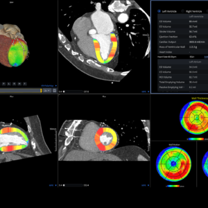 United Imaging uCT Heart