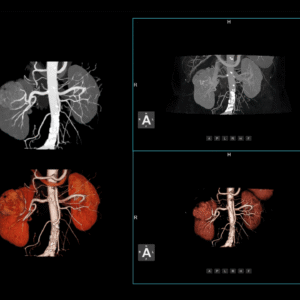 United Imaging uCT Dynamic Analysis