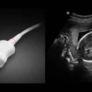 DC-40 - Primary Care Ultrasound Systems